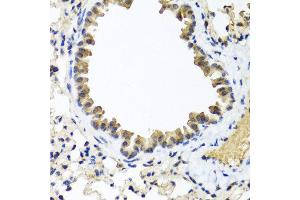 Immunohistochemistry of paraffin-embedded mouse lung using IFNL1 antibody at dilution of 1:100 (40x lens). (IL29 antibody)