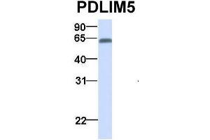 Host:  Rabbit  Target Name:  PDLIM5  Sample Type:  Human Fetal Liver  Antibody Dilution:  1.