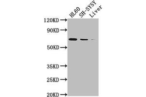 Western Blot Positive WB detected in: HL60 whole cell lysate, SH-SY5Y whole cell lysate, Mouse liver tissue All lanes: PTGS1 antibody at 1:2000 Secondary Goat polyclonal to rabbit IgG at 1/50000 dilution Predicted band size: 69, 65, 62, 57, 72, 73 kDa Observed band size: 72 kDa (Recombinant PTGS1 antibody)