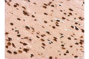 IHC-P Image GRB2 antibody detects GRB2 protein at nucleus on rat fore brain by immunohistochemical analysis.