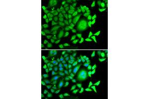 Immunofluorescence analysis of MCF-7 cells using CD47 antibody (ABIN5970938).