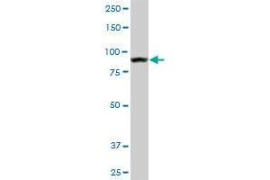 AMPD2 monoclonal antibody (M01), clone 2F5. (AMPD2 antibody  (AA 86-185))