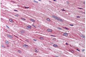 Human Heart (formalin-fixed, paraffin-embedded) stained with HIF1AN antibody ABIN214112 at 5 ug/ml followed by biotinylated goat anti-rabbit IgG secondary antibody ABIN481713, alkaline phosphatase-streptavidin and chromogen. (HIF1AN antibody  (N-Term))