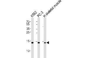 Western blot analysis of lysates from K562, PC-3 cell line and human skeletal muscle tissue lysate(from left to right), using HIST1H2BM Antibody (N-term) (ABIN6243575 and ABIN6577461).
