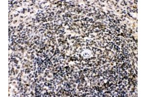 Immunohistochemistry (IHC) image for anti-BCL2-Interacting Killer (Apoptosis-Inducing) (BIK) (AA 1-123) antibody (ABIN4950330)
