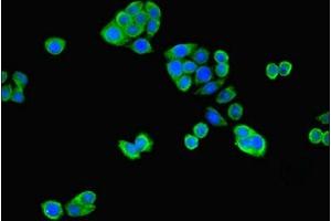 Immunofluorescent analysis of PC-3 cells using ABIN7151188 at dilution of 1:100 and Alexa Fluor 488-congugated AffiniPure Goat Anti-Rabbit IgG(H+L) (RNF31 antibody  (AA 421-700))