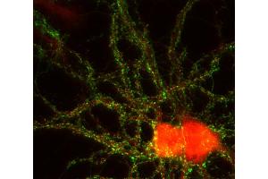 Immunocytochemistry (ICC) image for anti-Calcium Channel, Voltage-Dependent, gamma Subunit 3 (CACNG3) (AA 294-307) antibody (ABIN1742512) (CACNG3 antibody  (AA 294-307))