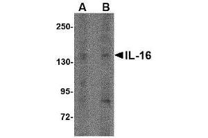Western blot analysis of IL-16 in rat brain tissue lysate with AP30408PU-N IL-16 antibody at (A) 1 µg/ml and (B) 2 μg/ml.