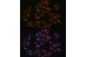 Immunofluorescence analysis of U-2 OS cells using SNX1 Rabbit pAb (ABIN6128725, ABIN6148234, ABIN6148235 and ABIN6224727) at dilution of 100 (40x lens). (Sorting Nexin 1 antibody  (AA 1-150))