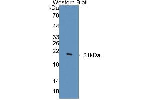 Figure. (DTYMK antibody  (AA 43-190))