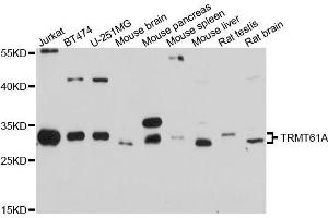 Western blot analysis of extracts of various cell lines, using TRMT61A antibody (ABIN5999106) at 1/1000 dilution.