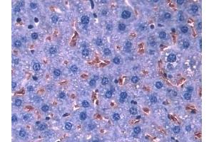 Detection of HBa1 in Mouse Liver Tissue using Polyclonal Antibody to Hemoglobin Alpha 1 (HBa1) (HBA1 antibody  (AA 1-142))