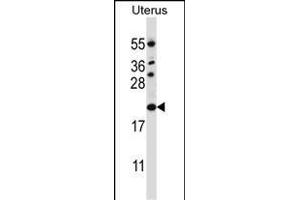 CDKN1B Antibody (C-term) (ABIN657225 and ABIN2846327) western blot analysis in human normal Uterus tissue lysates (35 μg/lane). (CDKN1B antibody  (C-Term))