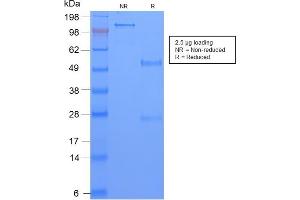 SDS-PAGE Analysis Purified TAG-72 Rabbit Recombinant Monoclonal Antibody (CA72/2869R). (Recombinant TAG-72 / CA72.4 antibody)