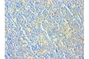 Immunohistochemistry of paraffin-embedded human tonsil tissue using ABIN7173325 at dilution of 1:100 (TCOF1 antibody  (AA 1189-1488))