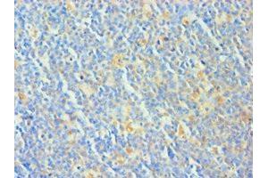 Immunohistochemistry of paraffin-embedded human tonsil tissue using ABIN7173325 at dilution of 1:100 (TCOF1 antibody  (AA 1189-1488))