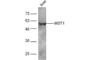 Mouse liver lysates probed with Rabbit Anti-MST1 Polyclonal Antibody, Unconjugated  at 1:5000 for 90 min at 37˚C. (MST1 antibody  (AA 385-487))