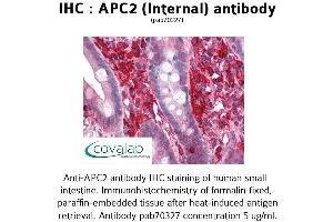 Image no. 2 for anti-APC Regulator of WNT Signaling Pathway 2 (APC2) (Internal Region) antibody (ABIN1731845) (APC2 antibody  (Internal Region))