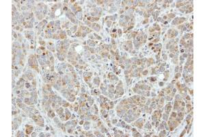 IHC-P Image Immunohistochemical analysis of paraffin-embedded MCF7 xenograft, using Edc3, antibody at 1:250 dilution.