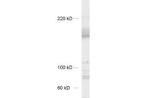dilution: 1 : 1000, sample: synaptic membrane fraction of rat brain (LP1) (Neurexin 3 antibody  (AA 1298-1494))