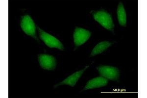 Immunofluorescence of purified MaxPab antibody to LIMK2 on HeLa cell. (LIMK2 antibody  (AA 1-686))