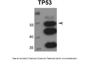 WB Suggested Anti-TP53 Antibody Titration: 0. (p53 antibody  (N-Term))