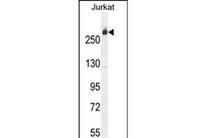 Western Blotting (WB) image for anti-Carbamoyl-Phosphate Synthetase 2, Aspartate Transcarbamylase, and Dihydroorotase (CAD) (AA 780-809) antibody (ABIN655062)
