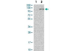 Western Blot analysis of Lane 1: negative control (vector only transfected HEK293T cell lysate) and Lane 2: over-expression lysate (co-expressed with a C-terminal myc-DDK tag in mammalian HEK293T cells) with ADAM15 polyclonal antibody .