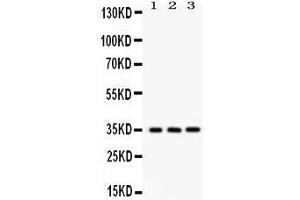 Anti- NMI Picoband antibody, Western blotting All lanes: Anti NMI  at 0. (NMI antibody  (AA 2-307))