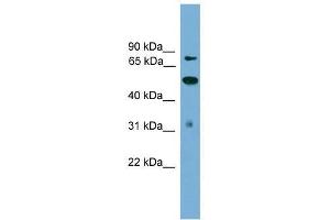 TLK2 antibody used at 0. (TLK2 antibody  (N-Term))
