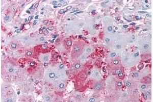 Human Liver (formalin-fixed, paraffin-embedded) stained with DUSP26 antibody ABIN213523 at 10 ug/ml followed by biotinylated goat anti-rabbit IgG secondary antibody ABIN481713, alkaline phosphatase-streptavidin and chromogen. (DUSP26 antibody  (Internal Region))