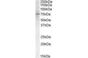 Western Blotting (WB) image for Proprotein Convertase Subtilisin/kexin Type 9 (PCSK9) (C-Term) peptide (ABIN369831)