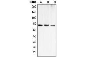 Western blot analysis of OATP1 expression in Jurkat (A), MCF7 (B), SHSY5Y (C) whole cell lysates. (SLCO1A2 antibody  (Center))