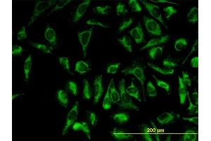 Immunofluorescence of monoclonal antibody to TOMM20 on HeLa cell. (TOMM20 antibody  (AA 1-145))