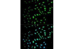 Immunofluorescence analysis of MCF7 cell using CD27 antibody.