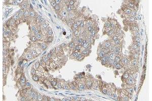 ABIN6278831 at 1/100 staining Human prostate tissue by IHC-P. (ADCY7 antibody  (Internal Region))