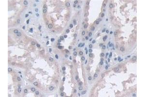 Detection of CPA4 in Human Kidney Tissue using Polyclonal Antibody to Carboxypeptidase A4 (CPA4)