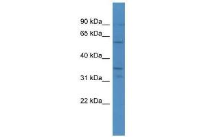 CA5A antibody used at 0. (CA5A antibody  (C-Term))
