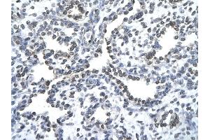 Rabbit Anti-ZNF212 antibody   Paraffin Embedded Tissue: Human Lung cell Cellular Data: alveolar cell of renal tubule Antibody Concentration: 4. (ZNF212 antibody  (N-Term))