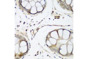 Immunohistochemistry of paraffin-embedded human gastric using WWTR1 antibody at dilution of 1:200 (40x lens).