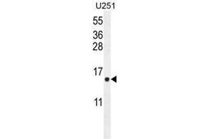 ATP6V0B Antibody (Center) western blot analysis in U251 cell line lysates (35µg/lane). (ATP6V0B antibody  (Middle Region))