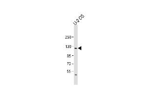 Anti-LIFR Antibody (C-term) at 1:2000 dilution + U-2OS whole cell lysate Lysates/proteins at 20 μg per lane.