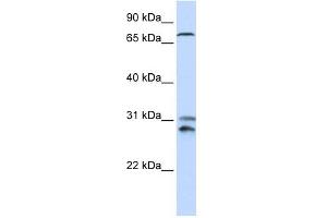 TLK2 antibody used at 1 ug/ml to detect target protein. (TLK2 antibody  (N-Term))