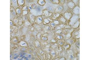 Immunohistochemistry of paraffin-embedded Human esophagus using DEFB132 Polyclonal Antibody at dilution of 1:100 (40x lens). (DEFB132 antibody)
