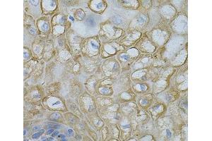 Immunohistochemistry of paraffin-embedded Human esophagus using DEFB132 Polyclonal Antibody at dilution of 1:100 (40x lens).