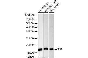 Western blot analysis of extracts of various cell lines, using FGF1 antibody (ABIN3021072, ABIN3021073, ABIN3021074 and ABIN6213939) at 1:1000 dilution. (FGF1 antibody  (AA 16-155))