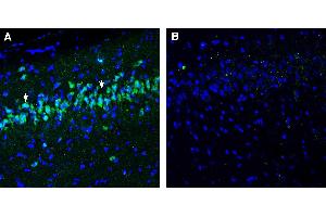 Expression of NPFFR1 in rat hippocampus. (NPFFR1 antibody  (Extracellular))
