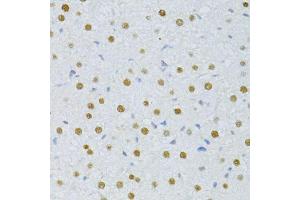 Immunohistochemistry of paraffin-embedded rat liver using SNRNP70 antibody. (SNRNP70 antibody  (AA 150-250))