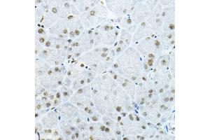 Immunohistochemistry of paraffin-embedded mouse pancreas using GB Rabbit pAb (ABIN6127943, ABIN6140978, ABIN6140979 and ABIN6225075) at dilution of 1:100 (40x lens).