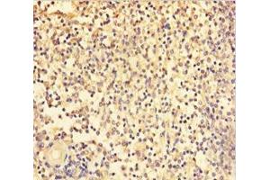 Immunohistochemistry of paraffin-embedded human spleen tissue using ABIN7172243 at dilution of 1:100 (TRAF5 antibody  (AA 1-557))